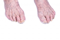 Pedicures and the Elderly Population
