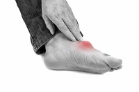 Gout Attacks May Be Painful