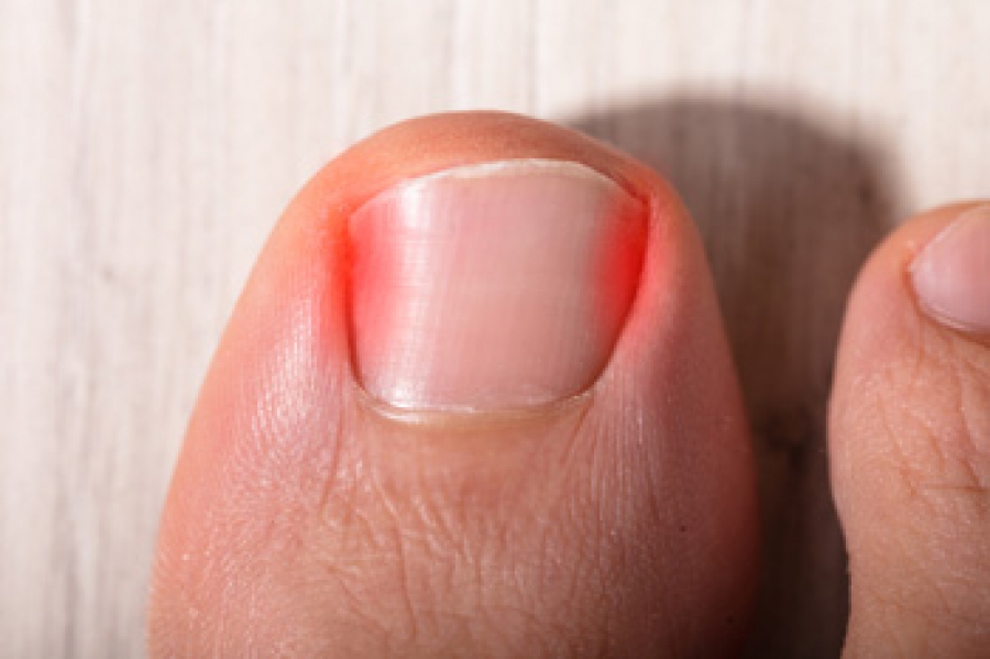 How to fix a broken nail – Mitty Melbourne Australia