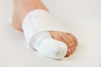 Treatment Options for a Broken Toe