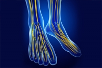 What Causes Tarsal Tunnel Syndrome?